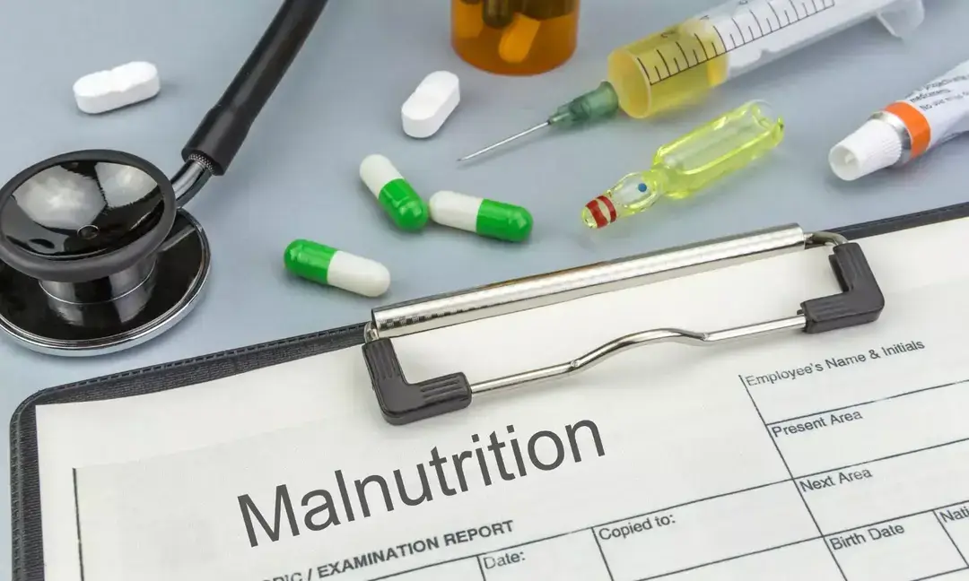 Malnutrition costs Pakistan $17 Billion annually