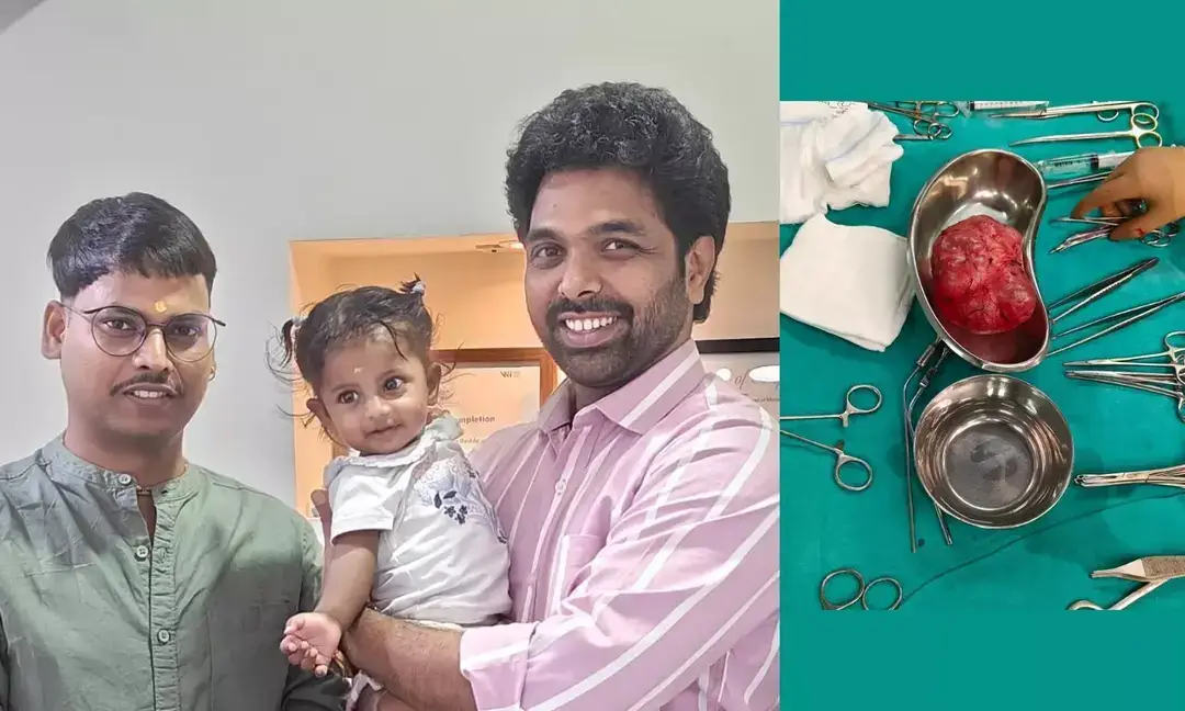 Doctors remove 500-gram abdominal tumour from six-month-old baby