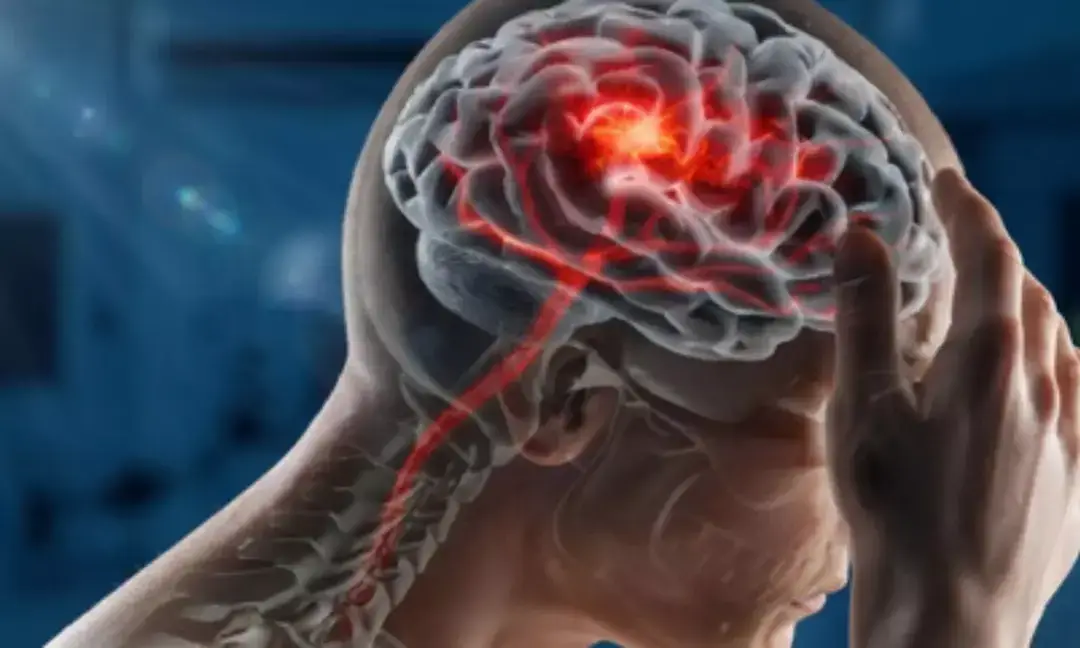Brain shows Alzheimer's signs before memory loss