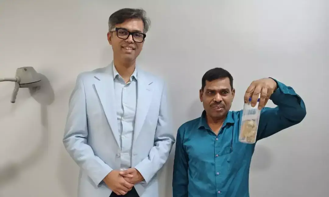 Rare 250g bladder stone removed in Navi Mumbai