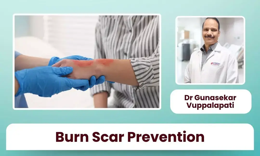 Can quick burn care improve recovery?
