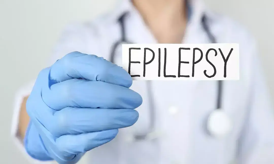 Experts stress early care for drug-resistant epilepsy