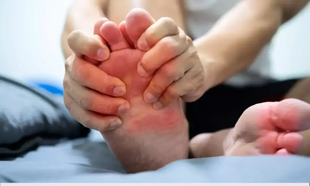 High uric acid early signs you should never ignore