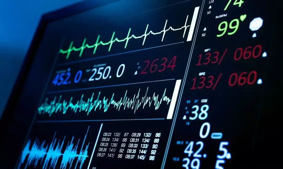Normal ECG may not mean a healthy heart: Doctor