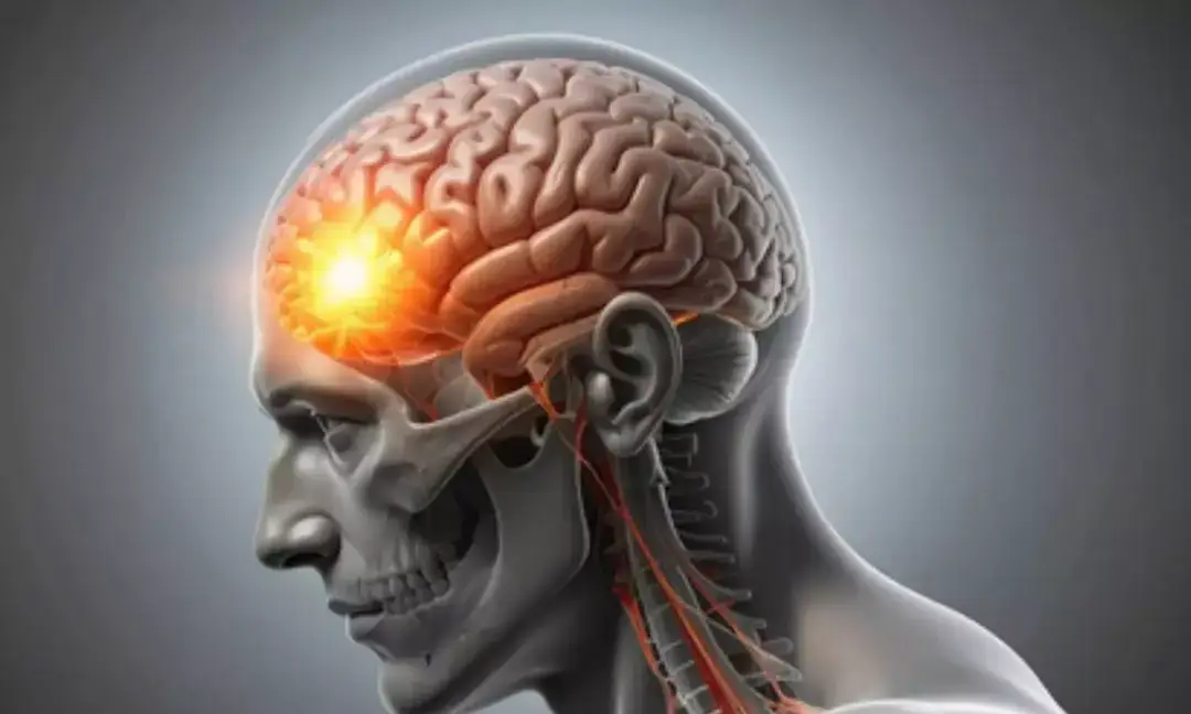 Controlling 3 midlife risks may delay dementia by 13 years: Study